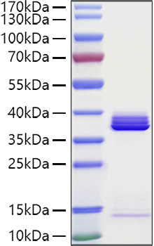 Recombinant Human Apolipoprotein E/ApoE Protein