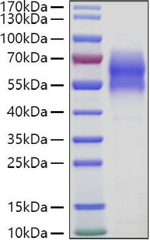 Recombinant Human WAIF1/5T4/TPBG Protein