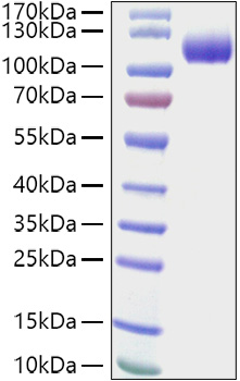 Recombinant Human CDCP1/gp140/CD318 Protein