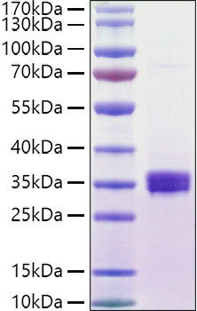 Recombinant Human NKG2D ligand 1/ULBP1 Protein