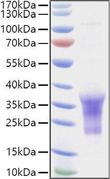 Recombinant Human B29/CD79B Protein