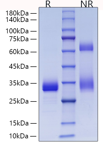 Recombinant Mouse Adiponectin/Acrp30/ADIPOQ Protein