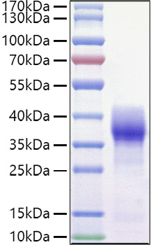 Recombinant Mouse Basigin/EMMPRIN/CD147 Protein