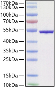 Recombinant SARS-COV-2 Nucleocapsid(B.1.1.529/Omicron) Protein