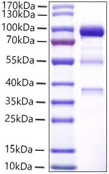 Recombinant Human Carboxypeptidase E/CPE Protein