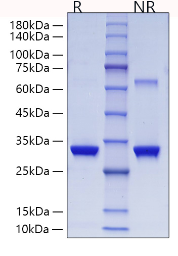 Recombinant Human Glutathione S-transferase omega-1/GSTO-1/SPG-R Protein