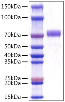 Recombinant Mouse CD5 Protein