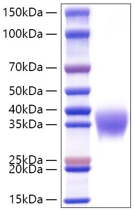 Recombinant Mouse Fc gamma RIIB/FCGR2B/CD32b Protein