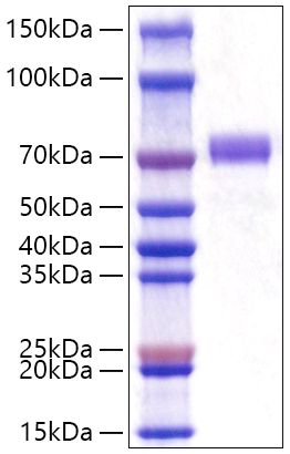 Recombinant Human GOLPH2/GOLM1 Protein