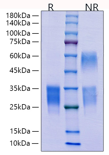 Recombinant Mouse CD69 Protein