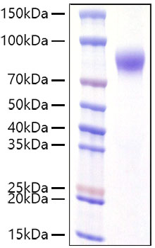 Recombinant Human IFNAR1 Protein