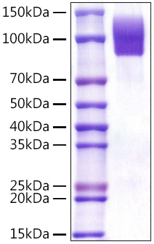 Recombinant Human SR-D1/CD68 Protein