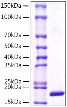 Recombinant Human Lipocalin-1/LCN1 Protein