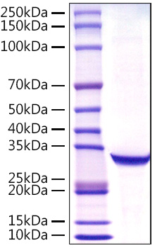 Recombinant Human PSA/KLK3 Protein