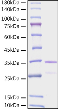 Recombinant Human EGLN1/PHD2 Protein