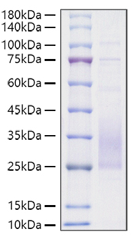 Recombinant Mouse TREM2 Protein