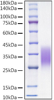 Recombinant Mouse CCL2/MCP-1 Protein