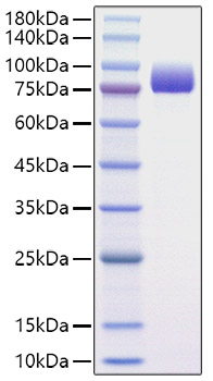 Recombinant Human Afamin/AFM Protein