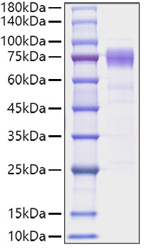 Recombinant Human IL-10RA/CD210 Protein