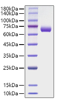 Recombinant Human IFN-gamma R2 Protein