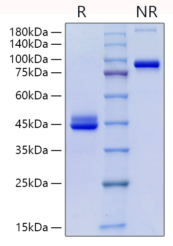 Recombinant Human CD9 Protein