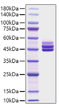 Recombinant Mouse IL-12B/IL-12 p40 Protein