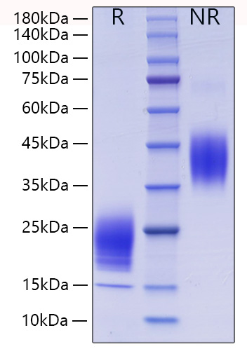 Recombinant Mouse IL-5 Protein