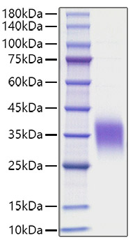 Recombinant Human IL-9 Protein