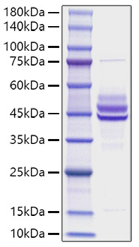 Recombinant Mouse IL-12B/IL-12 p40 Protein