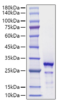 Recombinant Human HMGB2 Protein