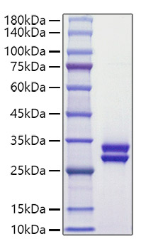 Recombinant Human Prolactin/PRL Protein