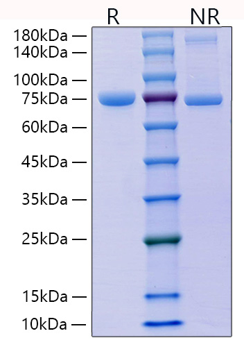 Recombinant Mouse E-Cadherin/CDH1/CD324 Protein