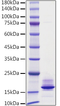 Recombinant Human Calcitonin/CALCA Protein