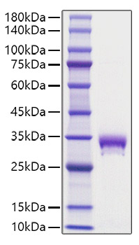 Recombinant Mouse EPO-R/Epor Protein