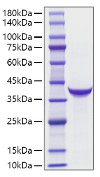 Recombinant Human PG II（PGC） Protein