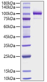 Recombinant Human Periostin/PN/POSTN Protein