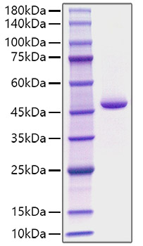 Recombinant Human Pepsin A-4/PGA4 Protein