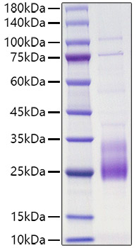 Recombinant Human IL-31 Protein