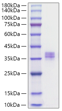 Recombinant Human MMP-7 Protein