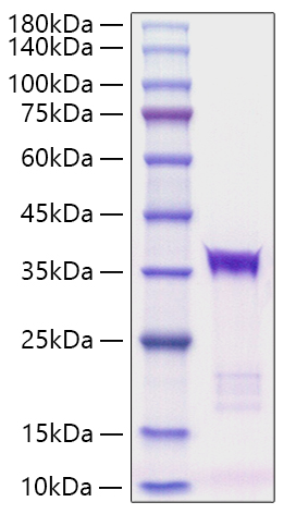 Recombinant human IGFBP-5 Protein