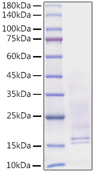 Recombinant Human Beta-nerve growth factor/NGFB Protein