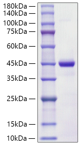 Recombinant Human S100-A7 Protein