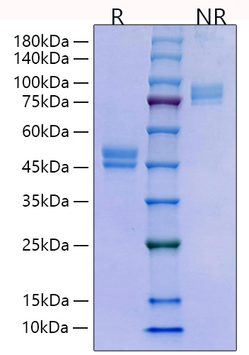 Recombinant Human WFDC2/HE4/WAP5 Protein