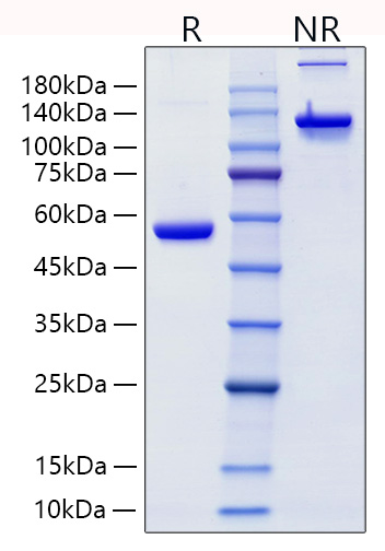 Recombinant Human Lipocalin-2/NGAL/LCN2 Protein