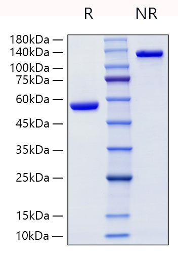 Recombinant Human Lipocalin-2/NGAL/LCN2 Protein