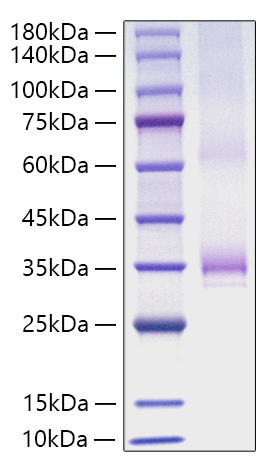 Recombinant Human Angiopoietin-1/ANG-1/ANGPT1(277-498) Protein