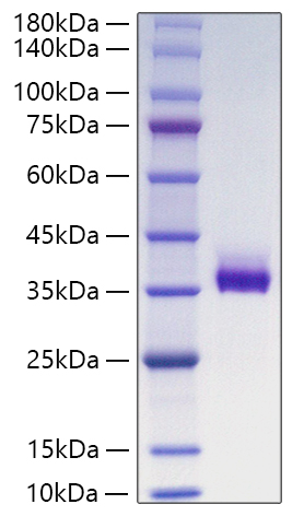 Recombinant Human Angiopoietin-like 3/ANGPTL3(237-460) Protein