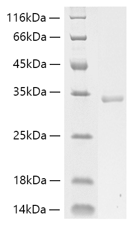 Recombinant Human Collagen I alpha 1/COL1A1 Protein