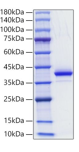 Recombinant Human CD81 Protein