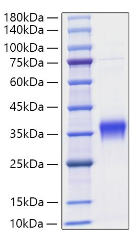 Recombinant Mouse IFN-beta Protein